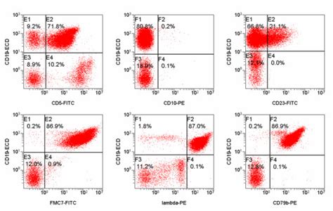 Flow Cytometry: Test, Use, Analysis & Results .